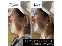 サロン ド ブラン(Salon de Blanc)/くすみも乾燥もお任せください