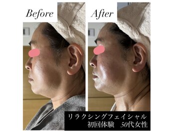 サロン ド ブラン(Salon de Blanc)/くすみも乾燥もお任せください
