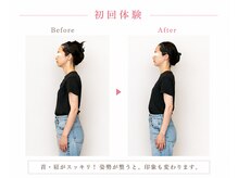 リフェイス(RE:FACE)/初回体験で変化実感
