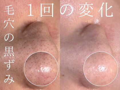 ルーツリー(Rootree)の写真