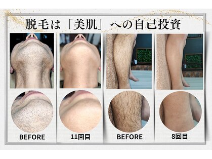 レイ(R.E.I)の写真