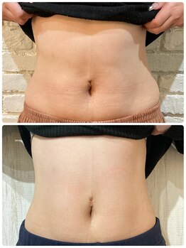 オリエンス(oriens)/ボディスカルプト