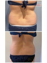 ルナグランデ(Luna grande.)/腰回りもお任せください