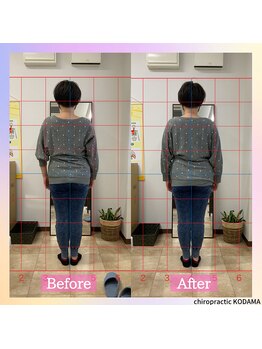 カイロプラクティック コダマ(KODAMA)/バランス矯正