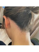 脱毛サロン ブラジリアンワックス ミーケアー(Mecare)/うなじ Wax脱毛♪