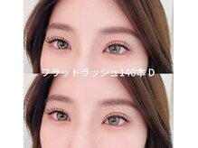 エイシェル/フラットラッシュ140本