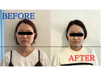 たかす整骨院/顔の歪み/丸顔/顔の大きさ