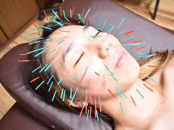 鍼屋フミ(鍼屋FUMI)/肌の奥まで響く、美容鍼の力