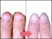 アモ 坂戸(’Amo)/深爪矯正・自爪育成 坂戸/北坂戸