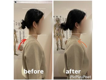 カワル整体 上通り院/方の位置で人相変わります。