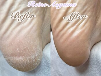 レーヌ青山(Reine Aoyama)/施術★本格ドイツ式フットケアB