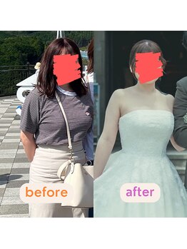 グレフル鍼灸接骨院 整体院 心斎橋/ブライダル/肩甲骨はがし/美鎖骨