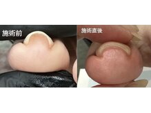 ディーソワン(De-soin)の雰囲気（【ネイル】カラーリング可能☆巻き爪ケアジェル導入）