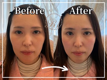 R-1ビューティーサロン 銀座/Before&After
