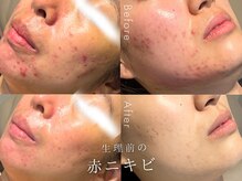 セルフミー 恵比寿(SELF Me...)の雰囲気（スキンケアで改善しなかった肌悩みにも効果抜群♪）