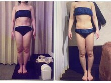 パーフェクトボディプレミアム 名古屋駅前店(PERFECT BODY PREMIUM)/お客様　ビフォーアフター（11）