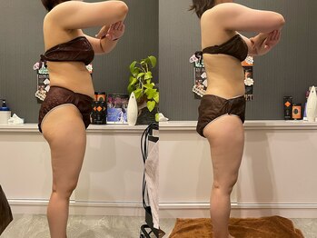 プシュケ(PSYCHE)/30代女性ビフォーアフター