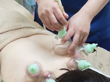 すずらん接骨院/吸い玉　肩