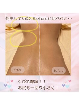 リミュール(Ri.miyuru)/リンパマッサージ