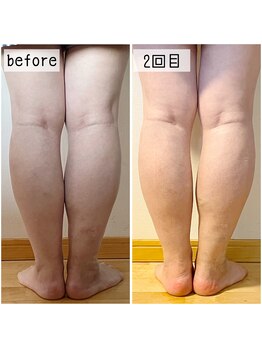 プライベートサロン からん/太腿けっこう隙間できるのねー