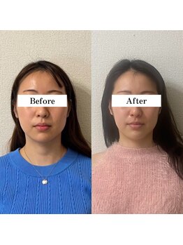 キュープ 奈良店(Qpu)/