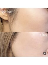 レイジュ(RayJU)/