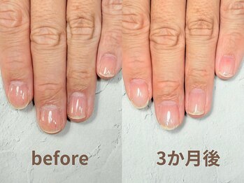 ナチュリア(Natulea)/剥離しやすい方での爪育