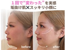 エルドットサナ(L.sana)