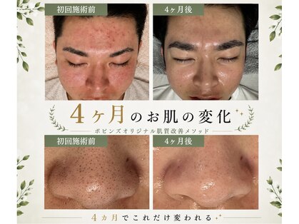 メゾンビューティーポピンズ 恵比寿(maisonbeauty poppins)の写真