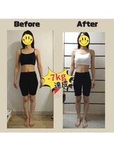 とだ整体院/ダイエット実績