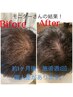 黄土よもぎ蒸し(40分)+頭髪の育毛促進グロッティプロ+ヒト幹細胞美容液¥15000