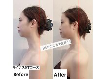 レイプラス 仙台店(RAY PLUS)/4Dパルスでスマホ首改善☆