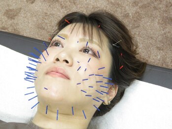 リンク 広島中区(Link)/施術風景