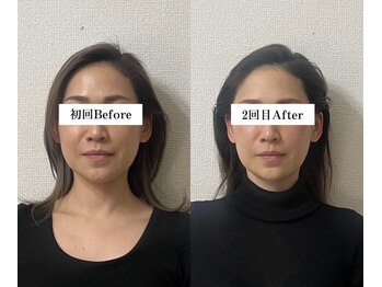 キュープ 奈良店(Qpu)/