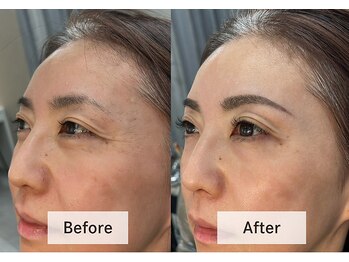 アンドミー 月島店(and me.)/眉デザインWAX＋まつエク/LED