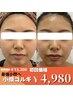 【速攻小顔へ】小顔コルギ　¥13,200→¥4,980