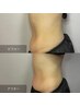【温活痩身】120分　和漢よもぎ蒸し＋温熱腸もみ＋痩身マシン+リンパ+腸診断