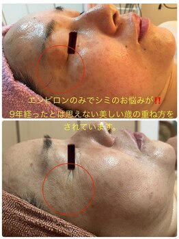 エステサロン エレガンス/