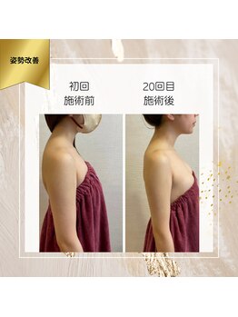 ロココ 町田店(Rococo)/20回で姿勢改善、二の腕も細く!