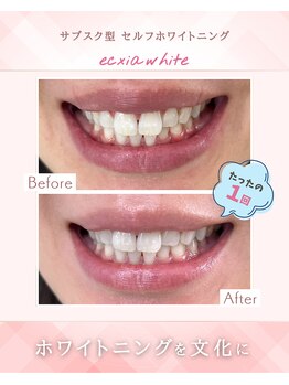 エクシア ホワイトニング 伊勢崎店/