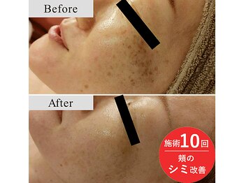 アールーム(Room)/