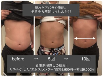 サロン ルイス アディクト(salon Lewis Addict)/【新型■EMスレンダー】