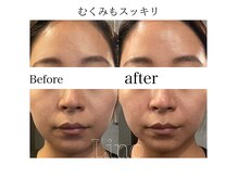 リノ(Lino)/むくみもスッキリ