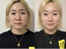 マリアーレの雰囲気（美顔筋SOSEI）