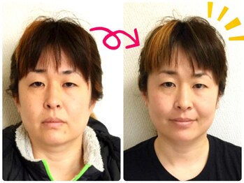 美容整体 ウェリナ 蟹江院/.【小顔矯正before→after】