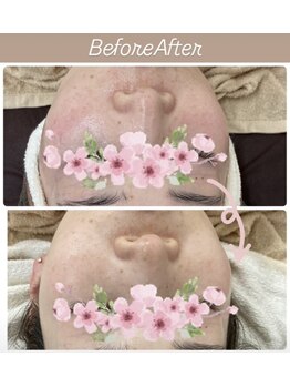 モスト(MOST)/ビフォーアフター♪