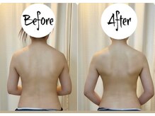 ティアエ(T-ae)/【ブライダルエステ】