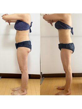 レディアント 石神井公園(radiant)/石神井公園/ダイエット