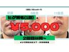 【都度払い】ひげ全体脱毛¥5000