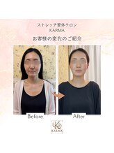 カルマ(KARMA)/MENU【小顔ストレッチ】